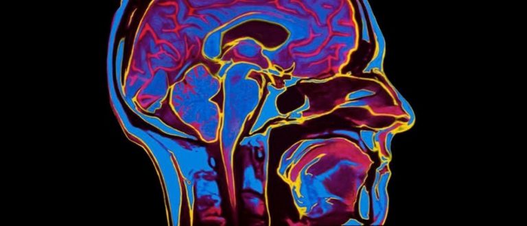 6 Ways Heropost Tackles Mental Awareness